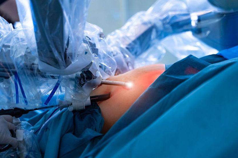 Arthroscopic Debridement Guide