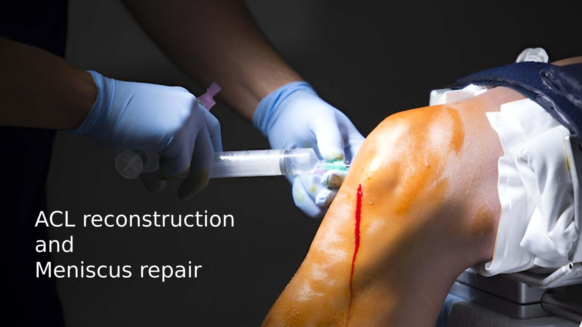 ACL reconstruction and meniscus repair